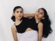 23岁双头连体姐妹公开：共享身体的真实感受！